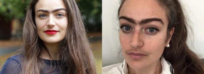 31χρονη σταμάτησε να βγάζει φρύδια και μουστάκι επειδή νιώθει εξίσου θηλυκή με τις τρίχες της