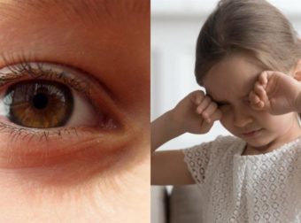 Ηπατίτιδα σε παιδιά: Το πρώτο σημάδι στα μάτια που πρέπει να προσeξουν οι γονείς και τα 5 συμπτώματα