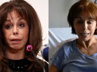 Βούλα Πατουλίδου για πλαστικές επεμβάσεις: «Μου έξυσαν όλο πρόσωπο, απίστεuτος πόνος, αιμορραγούσα συνεχώς»