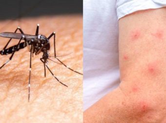 Κουνούπια: Οι 4 ομάδες ανθρώπων που είναι πρώτες στις «προτιμήσεις» τους