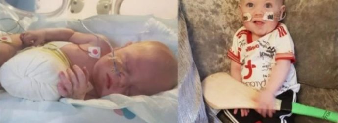 Μαχητής της ζωής: Μωράκι που δεν θα επιβίωνε στον τοκετό σήμερα είναι 10 μηνών και πάει σπίτι του για 1η φορά