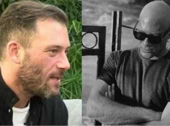 Συγκλονίζει ο Αντίνοος Αλμπάνης: «Έχασα δουλειά, επειδή έπεσαν τα μαλλιά μου, ο καρκίνος είναι στίγμα»