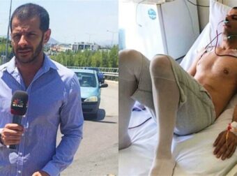 «Ζω με ένα πλαστικό πράγμα στο στόμα που μου δυσκολεύει την ζωή αλλά χαμογελάω»
