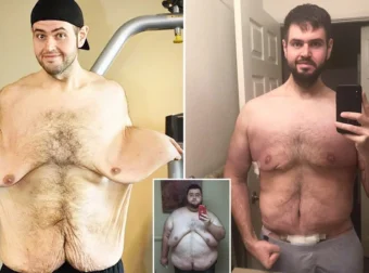 Συγκλονιστικό – Έχασε 140 κιλά, μεταμορφώθηκε και παντρεύτηκε τη γυναίκα της ζωής του (ΦΩΤΟ)