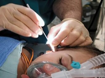 Γυναίκα πήγε στους γιατρούς με «βουητό» στο αυτί και αυτοί ανακάλυψαν κάτι ανατριχιαστικό μέσα της