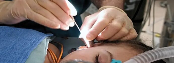 Γυναίκα πήγε στους γιατρούς με «βουητό» στο αυτί και αυτοί ανακάλυψαν κάτι ανατριχιαστικό μέσα της