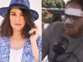 Μεγαλείο ψυχής από την Παλιοσπύρου – Αναλαμβάνει τα έξοδα του μάγειρα που κάηκε από λάδι