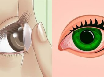 5 προφυλάξεις για να αποφύγετε την προσβολή από κορωνοϊό μέσω των ματιών